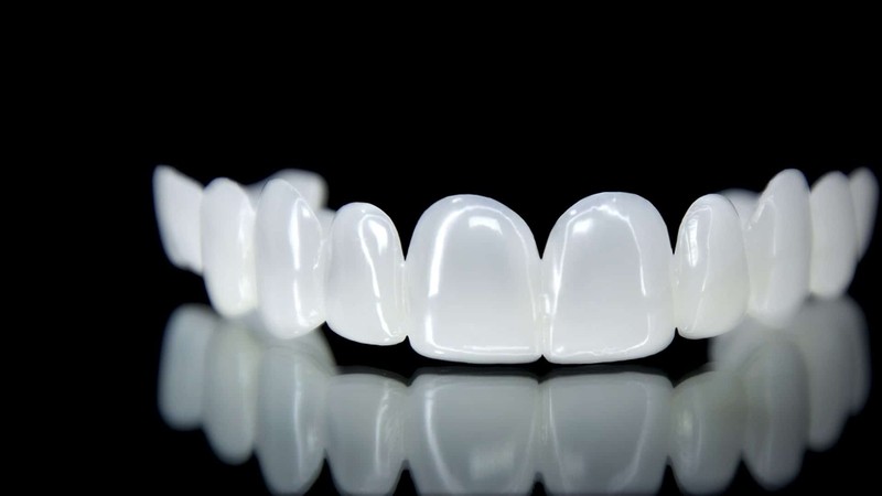 Bọc răng sứ HT Smile có tốt không? Bảng giá năm 2026 1 Răng sứ HT Smile là loại răng được sản xuất từ vật liệu sứ cao cấp