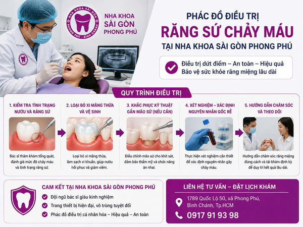 Nguyên nhân răng sứ bị chảy máu và cách xử lý an toàn 6 Phác đồ điều trị dứt điểm biến chứng răng sứ chảy máu tại Nha khoa Sài Gòn Phong Phú