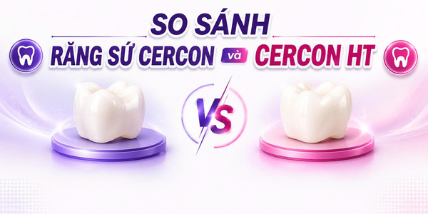 Bọc răng sứ Cercon HT là gì? Bọc sứ Cercon HT giá bao nhiêu? 2 So sánh răng sứ Cercon và Cercon HT