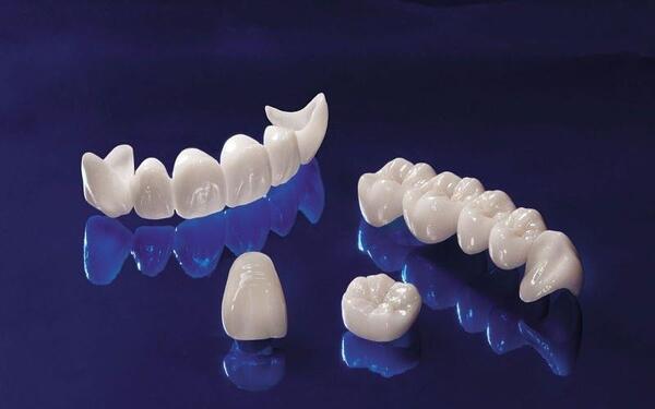 Bọc răng sứ Cercon HT là gì? Bọc sứ Cercon HT giá bao nhiêu? 4 Bảng giá răng sứ Cercon HT chính hãng tại Nha khoa Sài Gòn Phong Phú