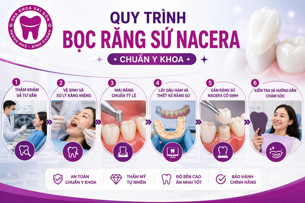 Bọc răng sứ Nacera có tốt không? Giá bao nhiêu tiền? 4 Quy trình bọc răng sứ Nacera chuẩn y khoa