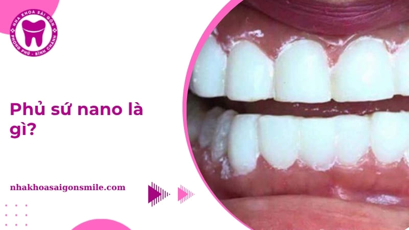 phủ sứ nano
