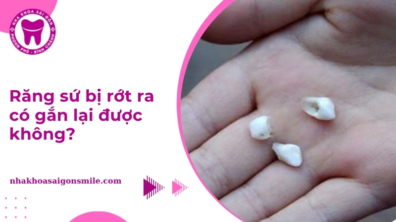 răng sứ bị rớt ra