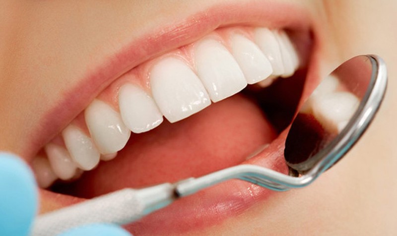 Ưu và nhược điểm của răng sứ Bio Esthetic Ưu và nhược điểm của răng sứ Bio Esthetic