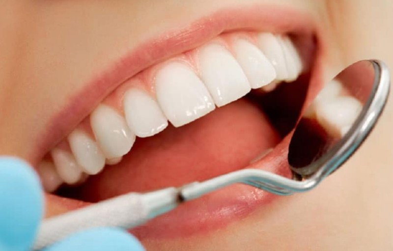 Ưu và nhược điểm của răng sứ crom cobalt Ưu và nhược điểm của răng sứ crom cobalt