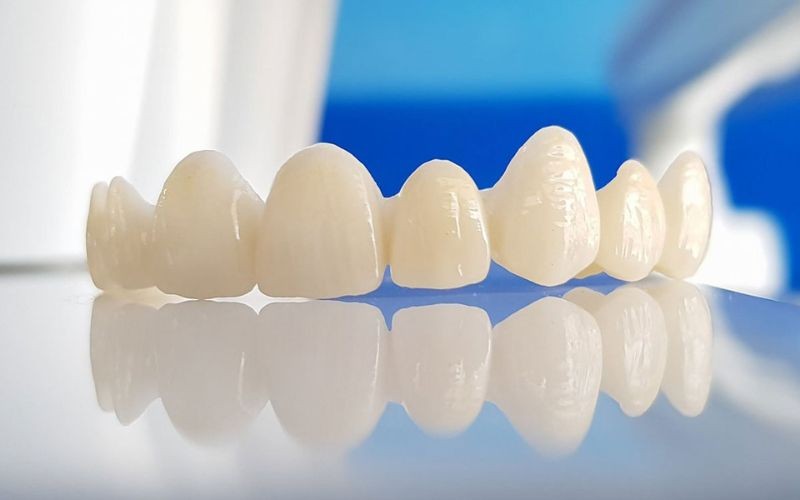 Cấu tạo và đặc điểm nổi bật của răng sứ Dmax Cấu tạo và đặc điểm nổi bật của răng sứ Dmax
