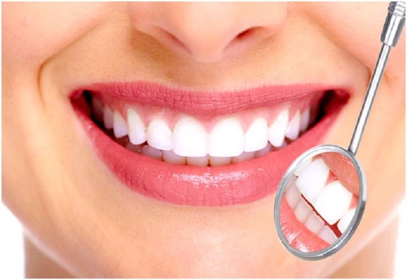 Ưu và nhược điểm khi bọc răng sứ Dmax Ưu và nhược điểm khi bọc răng sứ Dmax