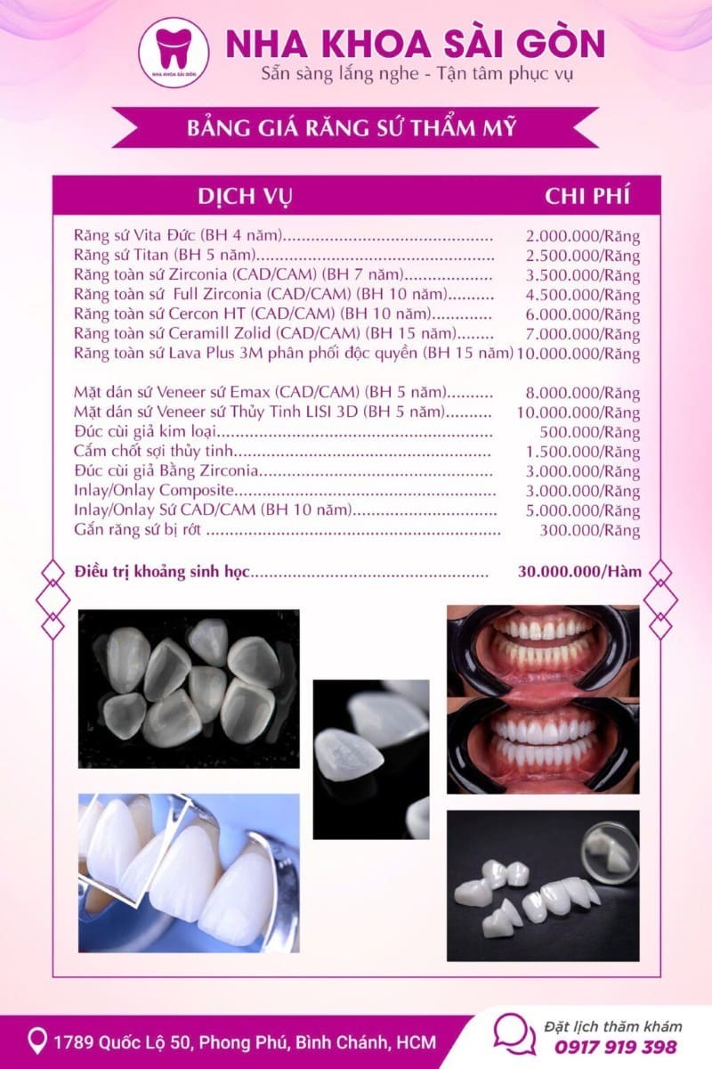 Bảng giá răng sứ thẩm mỹ tại nha khoa Sài Gòn Phong Phú Bảng giá răng sứ thẩm mỹ tại nha khoa Sài Gòn Phong Phú