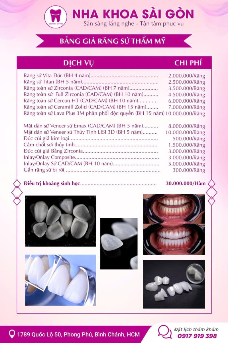 Bảng giá răng sứ tại nha khoa Sài Gòn Phong Phú Bảng giá răng sứ tại nha khoa Sài Gòn Phong Phú