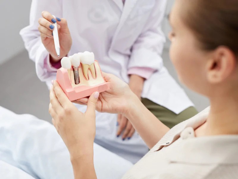 Ưu và nhược điểm của phương pháp cấy ghép mini implant Ưu và nhược điểm của phương pháp cấy ghép mini implant