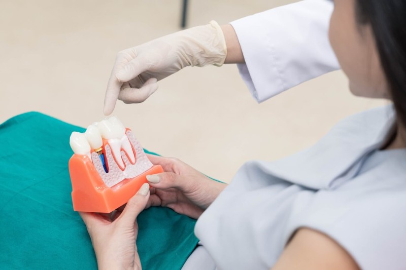 Các yếu tố ảnh hưởng đến thời gian cấy ghép implant Các yếu tố ảnh hưởng đến thời gian cấy ghép implant